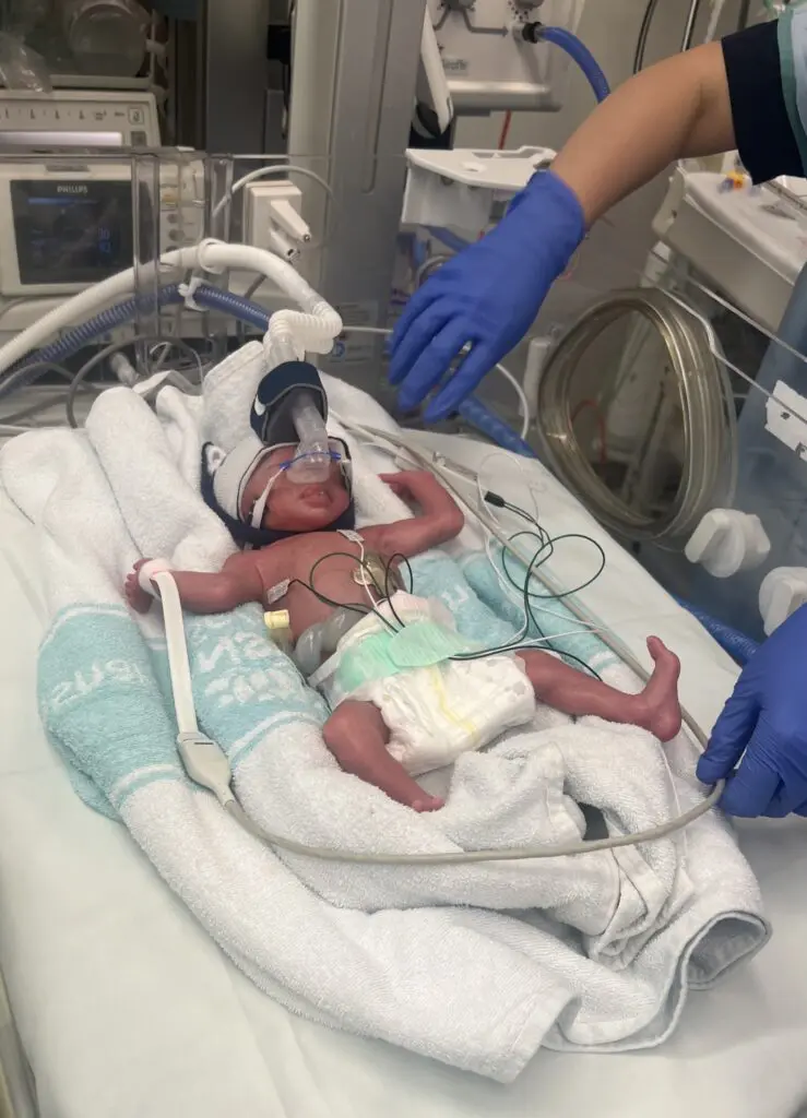 Newborn at RNSH NICU