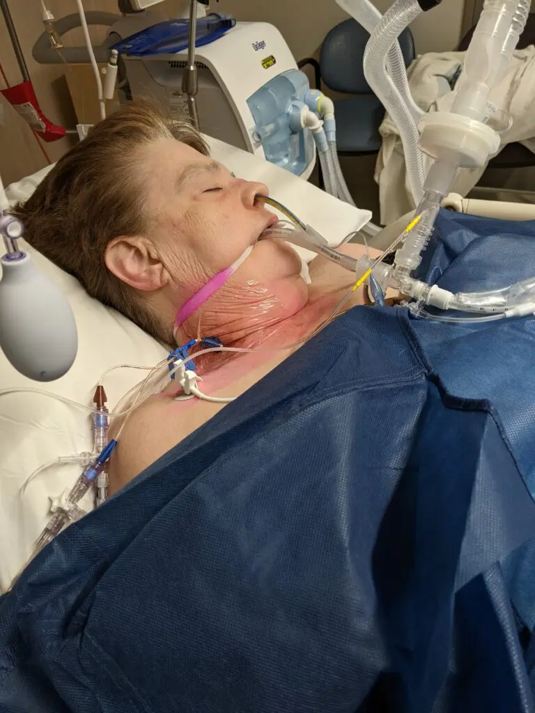 Woman in Ryde Hospital ICU receiving medical support