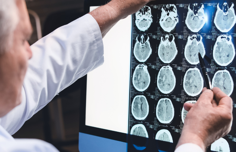 Neurologist assessing brain scan