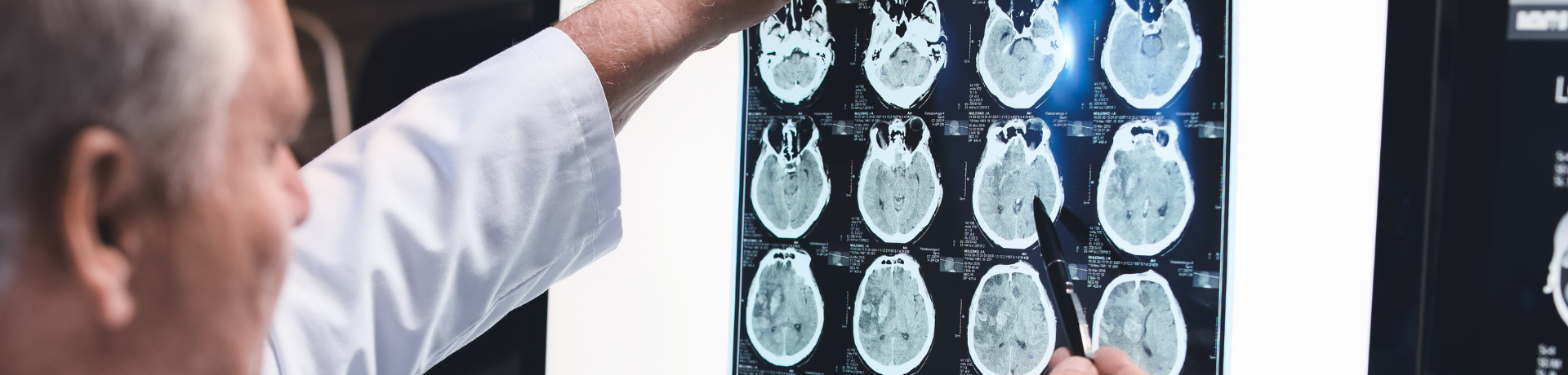 Neurologist assessing brain scan