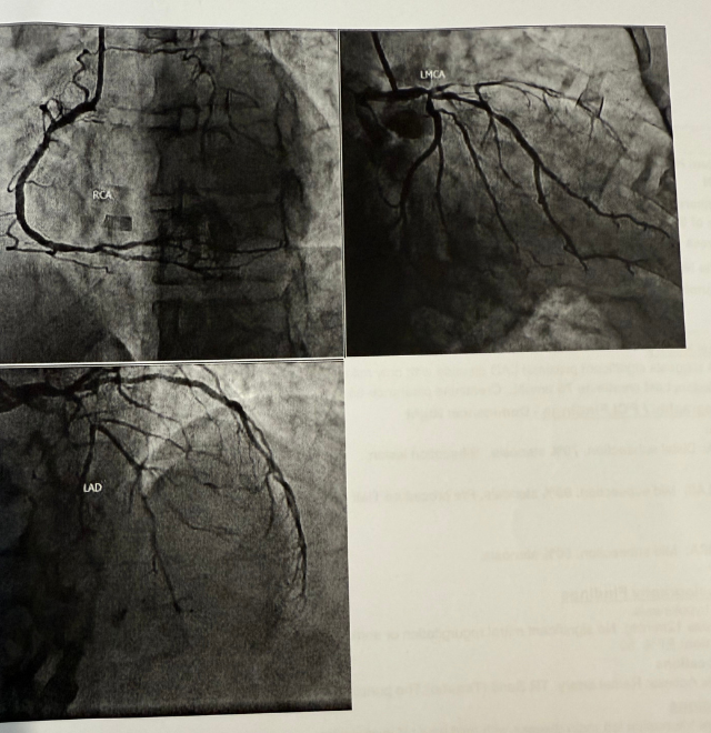 Frank's heart scans